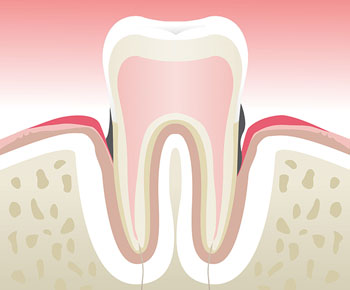 Dentiste Paris 1